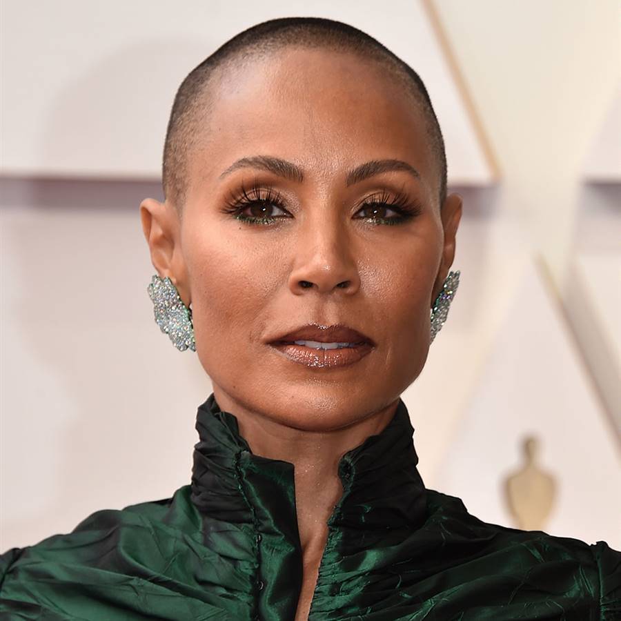 15 famosas que han sufrido alopecia femenina