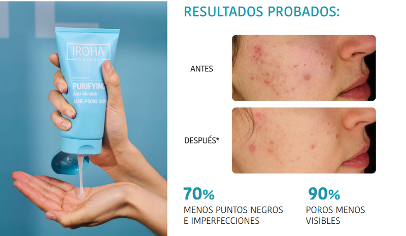 Limpiador Purificante Antiimperfecciones de Iroha Nature