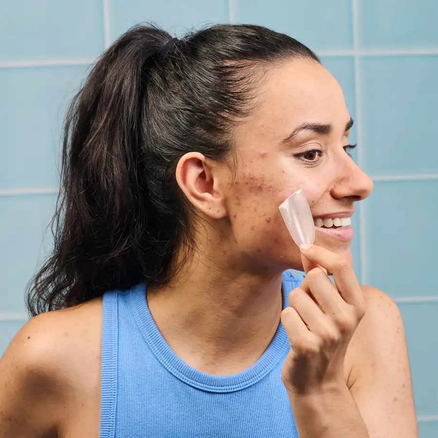 Adiós a los brotes imposibles: así funcionan los nuevos parches para granos XL que serán tus mejores aliados de belleza