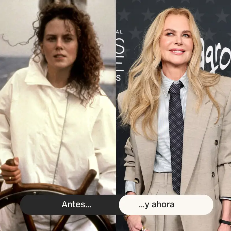 Nicole Kidman Antes y Ahora
